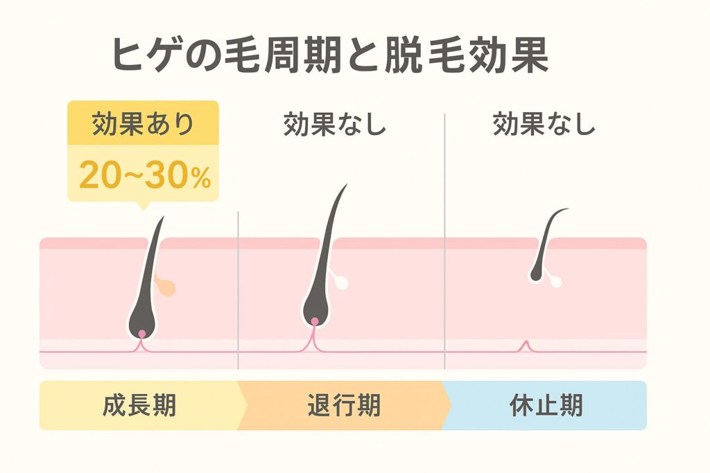 ヒゲの毛周期を解説する図。成長期・退行期・休止期の3段階を横並びで表示し、成長期の毛は「効果あり20〜30％」、退行期・休止期の毛は「効果なし」と示している。