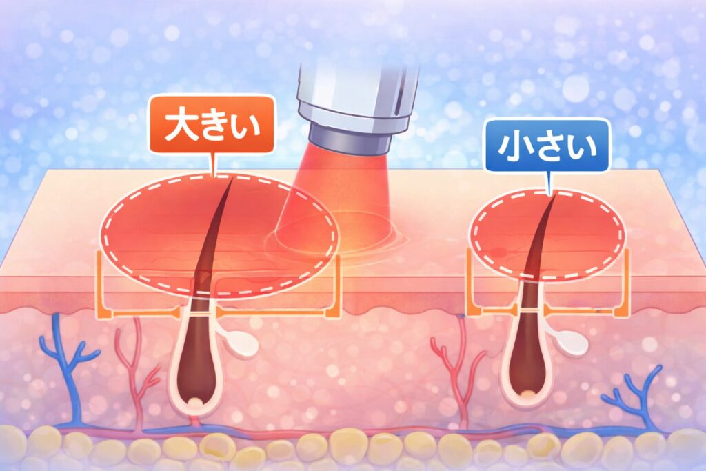 spot-size-laser-skin-area